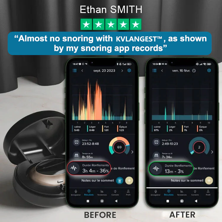 ✨ OWTUNLY™ Professional Anti-snoring Device